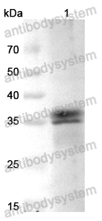 Anti-Monkeypox virus/MPXV B5R Polyclonal Antibody